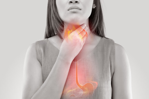 Female experiencing Gastroesophageal (Acid) Reflux