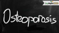 How Osteofos Works: Understanding Alendronate for Bone Health